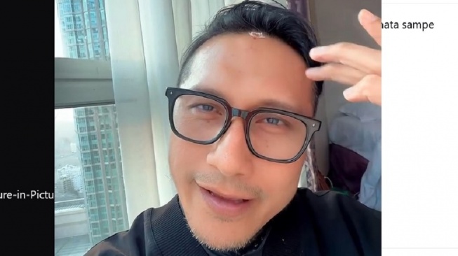 Kepalanya Bocor saat Umrah, Arie Untung: Mungkin Sujudnya Kurang