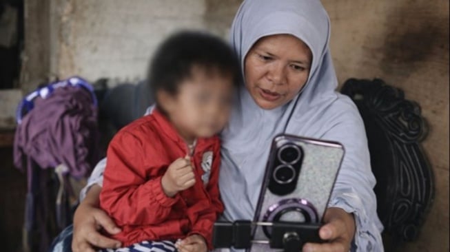 Perjuangan Ibu Balita Pengidap Penyakit Langka di Karanganyar, Bertahan Hidup dari Live TikTok