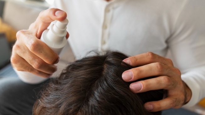 5 Hair Tonic untuk Atasi Ketombe dan Gatal, Kulit Kepala Jadi Lebih Sehat