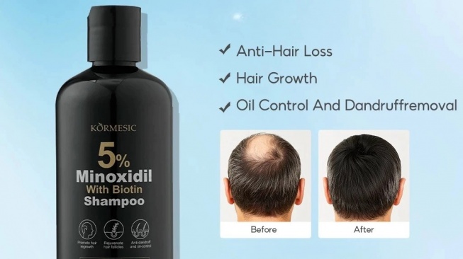 OSADA OSADI Shampo Minoxidil 5% (Shopee/OSADA OSADI Official Store)