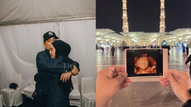 4 Artis Kehilangan Anak Dalam Kandungan, Terbaru Rizal Armada