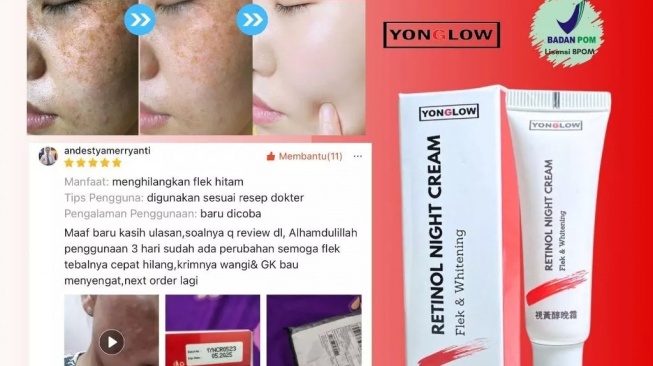Yonglow Retinol Night Cream (Shopee/Yonglow Official Store)