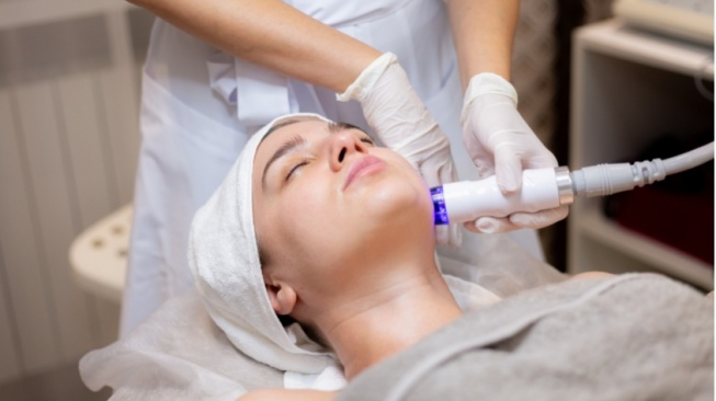 Berapa Harga Terapi Laser Wajah untuk Hilangkan Flek Hitam? Ini Rinciannya