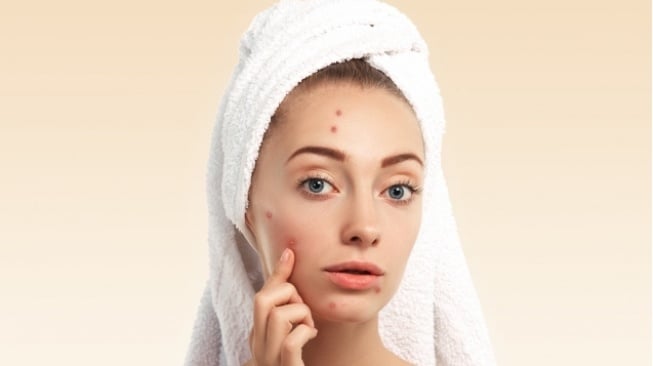 Jerawat Makin Parah Setelah Pakai Skincare Baru? Ini Perbedaan Breakout dan Purging
