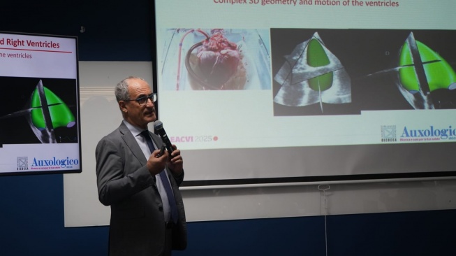 3D Echocardiography: Teknologi Kunci untuk Diagnosis dan Penanganan Penyakit Jantung Bawaan