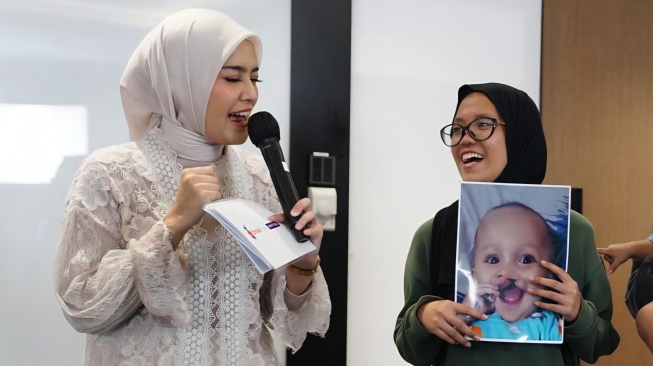 Bibir Sumbing pada Bayi: Penyebab, Waktu Operasi, dan Cara Perawatannya