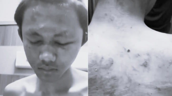 Update Kasus Kekerasan Mahasiswa UNDIP: Arnendo Terlapor Dugaan Pelecehan