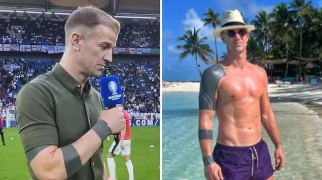 Joe Hart Ungkap Makna Tato Hitam Pekat yang Jadi Baju Zirahnya