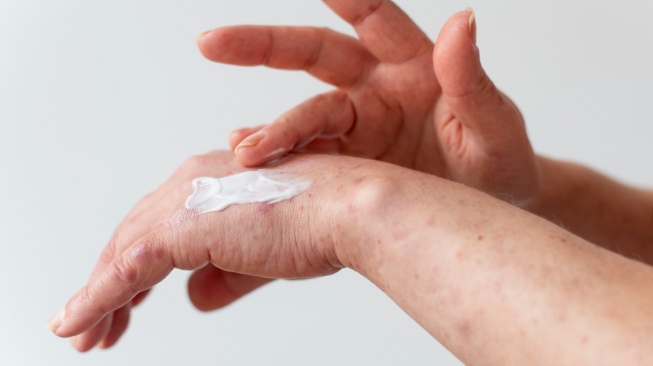 5 Rekomendasi Body Lotion untuk Menghilangkan Bekas Luka