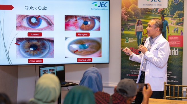 Glaukoma Bisa Sebabkan Kebutaan Tanpa Gejala, Ini Hal-Hal yang Perlu Diketahui