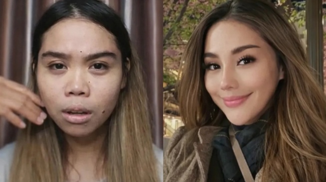 Lagi Heboh Isu Selingkuh, Dokter di Balik Operasi Plastik Cindy Rizky Aprilia Bikin Penasaran