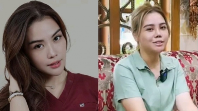 Diduga Selingkuhan Suami Maissy, Cindy Rizky Aprilia Ketahuan Oplas di Sini