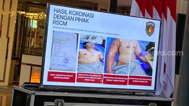 Wakil Koordinator Komisi untuk Orang Hilang dan Korban Tindak Kekerasan (KontraS) Andrie Yunus disiram air keras oleh orang tidak dikenal. (Ist)