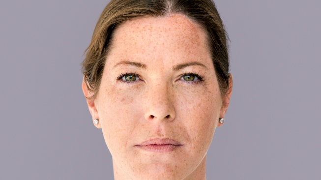 5 Pilihan Cream Penghilang Flek Hitam untuk Usia 40 Tahun di Apotek