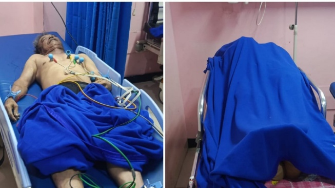 Tragedi Maut di Basement TB Simatupang: Niat Tolong Rekan, 4 Pekerja Tewas Terjebak Gas Beracun