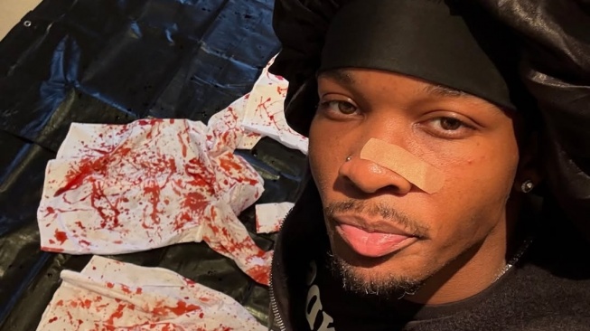 D4vd dituduh membunuh gadis 14 tahun bernama Celeste Rivas Hernandez. [Instagram]