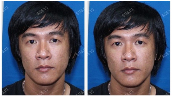 Tampang Frendry Dona, Bos Lab Vape Narkoba Buron yang Manfaatkan Celah Sistem Ojol!