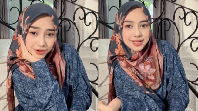 Penampilan Berubah Drastis, Ria Ricis Akui Jalani Operasi Hidung