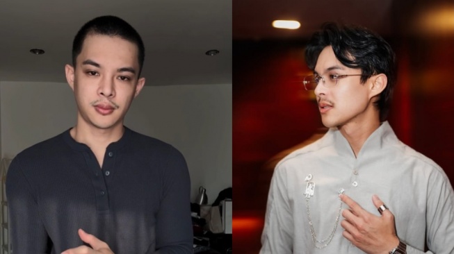 Rey Mbayang Idap Autoimun Psoriasis, Alami Kerontokan Rambut Parah