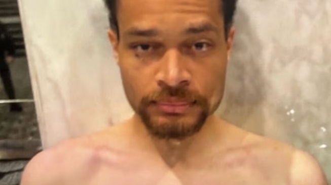 Kata-kata Berani Penembak di Gala Dinner Donald Trump