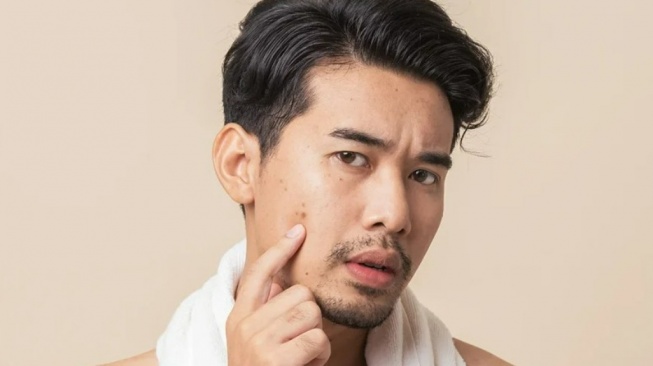 Pria Harus Tahu, Begini Cara Tepat Merawat Kulit Wajah Berjerawat karena Hormon Kortisol