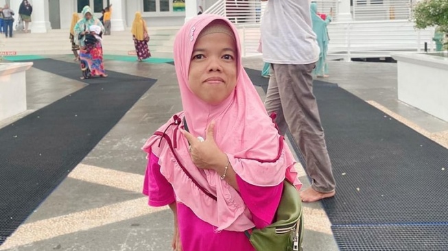 Disamakan dengan Hewan, Uni Bakwan Roza Lisna Tersinggung Jadi Bahan Ejekan Dokter