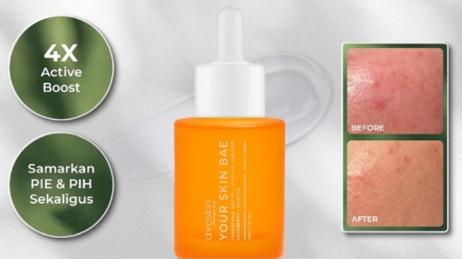 Serum Avoskin Your Skin Bae Tranexamic Acid (Shopee)