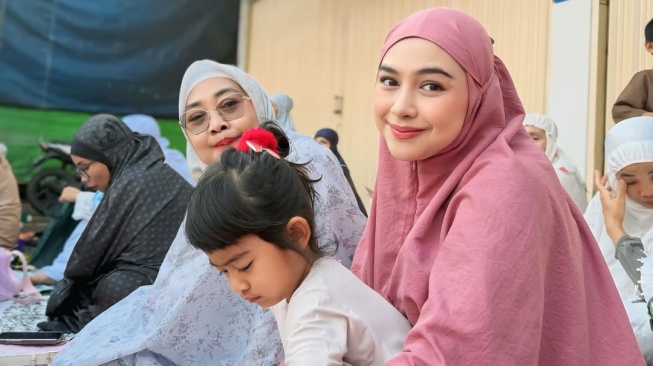 Dituding Pasang Piercing Pasca Operasi Hidung, Ria Ricis Akhirnya Bongkar Fakta Sebenarnya