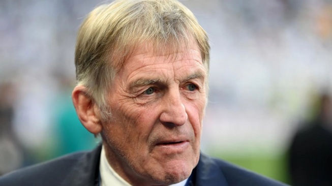 Legenda Liverpool Kenny Dalglish Jalani Perawatan Kanker