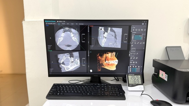 Mengenal Rontgen Gigi 3D: Teknologi yang Bantu Diagnosis Lebih Akurat dan Cepat