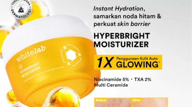 Whitelab Hyperbright Brightening Moisturizer (Shopee)