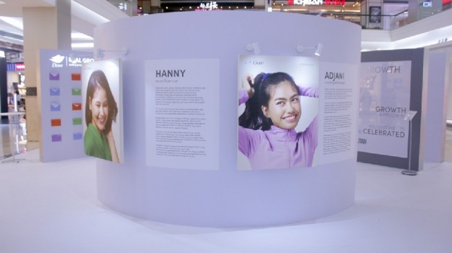 Banyak Ibu Mengalaminya, Ini Kisah Bangkit dari Kerontokan Rambut Pascapersalinan (Dok. Istimewa)