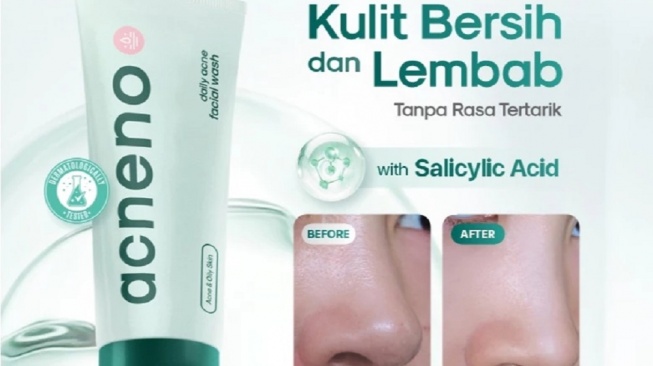 Acneno Daily Acne Facial Wash (Shopee)