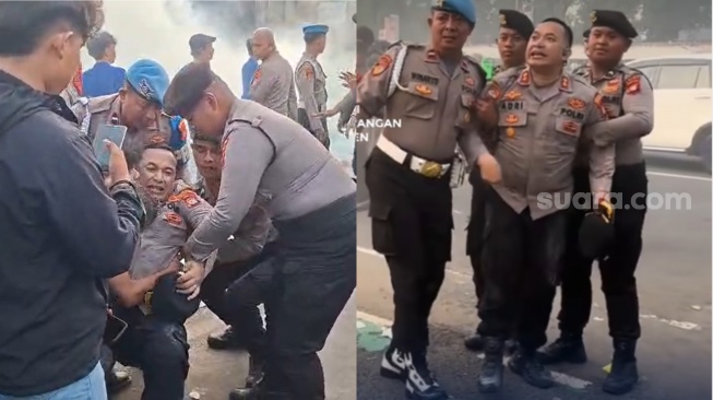 Teriak 'Kaki Saya Patah' saat Jaga Demo di DPR, Ternyata Ini Diagnosis Medis AKBP Adri Desas