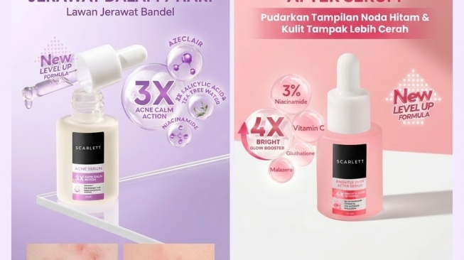 Bedanya Scarlett Whitening Acne Serum vs Brightly Ever After, Mana yang Cocok untuk Kulit Anda?