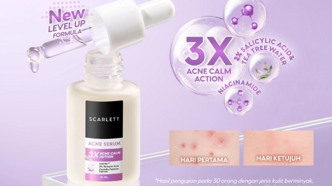 Serum Scarlett Whitening untuk Jerawat (Shopee)