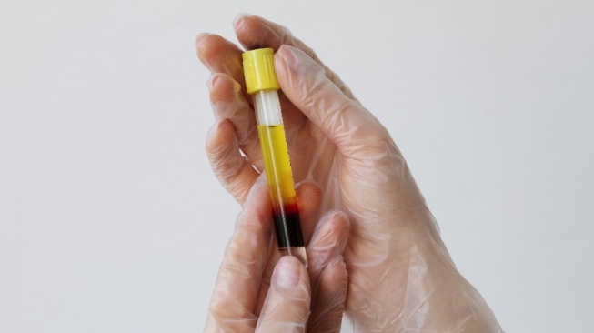 Ekosistem Produk Obat Derivat Plasma Mulai Dibangun, Indonesia Siapkan Jaringan Bank Plasma