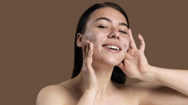 4 Sabun Cuci Muka untuk Kulit Berminyak, Berjerawat, dan Komedo dengan Review Pembeli