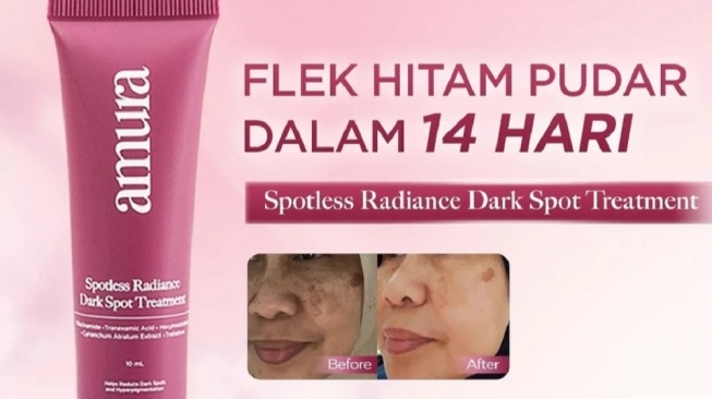 Amura Spotless Radiance Dark Spot Treatment (Shopee)