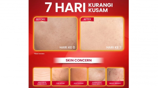 Hanasui Power Retinol Expert Serum review (shopee)