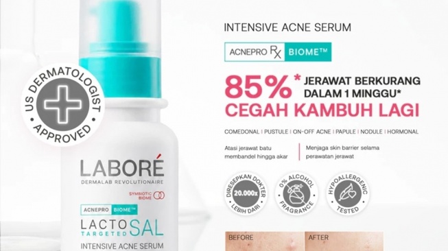 LABORÉ Sensitive Skin Care Intensive Acne Serum (Shopee)