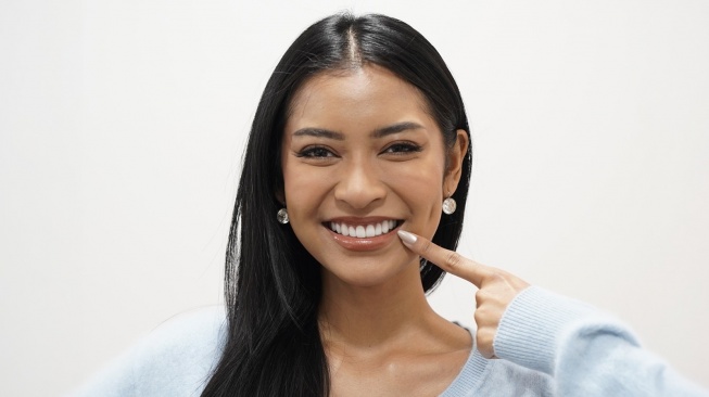 Bukan Putih Mencolok, Putri Indonesia Agnes Rahajeng Tunjukkan Tren Veneer Natural Kian Digemari