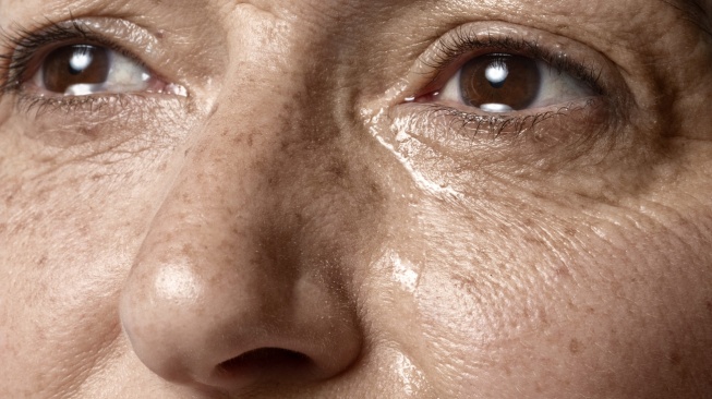 7 Tanda Kulit Rusak Akibat Tidak Memakai Sunscreen secara Rutin