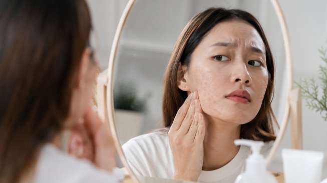 3 Serum Ampuh Basmi Bruntusan dan Noda Hitam Bekas Jerawat, Wajah Mulus Tanpa Bekas