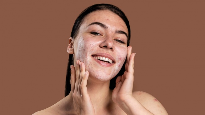 7 Sabun Cuci Muka Salicylic Acid untuk Jerawat dan Komedo, Mulai Rp20 Ribuan
