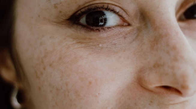 5 Serum Flek Hitam yang Cepat Menyamarkan Noda Hitam di Wajah Sesuai Review