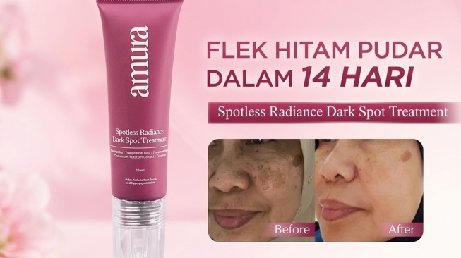 Amura Spotless Radiance Dark Spot Treatment (Shopee)
