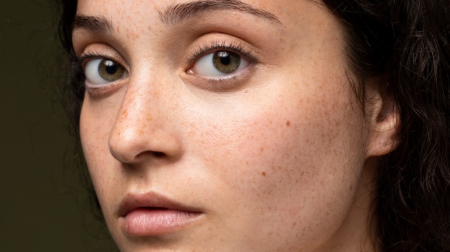 Urutan Skincare Malam untuk Kulit Sensitif dengan Rosacea dan Flek Hitam