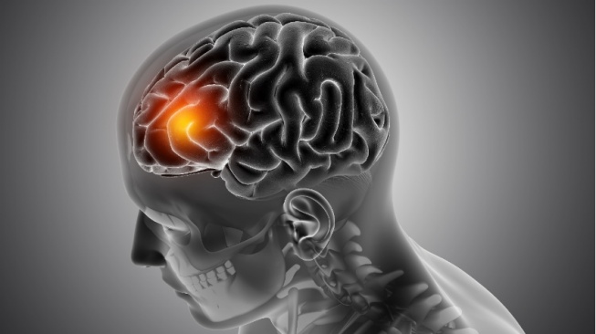 Hati-Hati! 5 Kebiasaan Kecil ini Bisa Bikin Kamu Mengalami Brain Rot