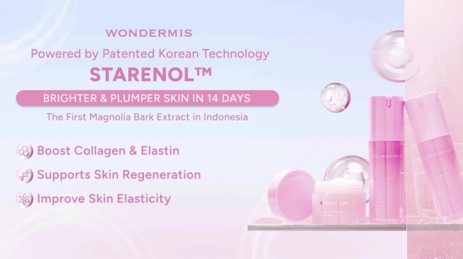 (Dok: Wondermis)